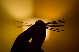 C:\Users\inggieho\Desktop\Inggie\DL\CMER\CMER - HK\Marketing & Promotion\Acupuncture\acu pics\New folder\AcupunctureNeedlesAreSmall.jpg